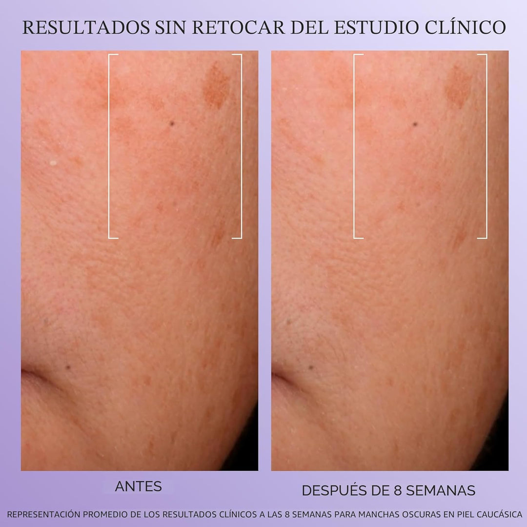 Lancôme Rénergie H.C.F. Triple Serum - Suero de ácido hialurónico p...