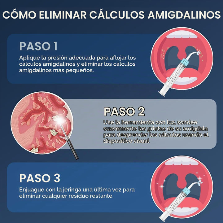 Removedor de piedras amígdalas con cámara \u2013 Kit de eliminación...