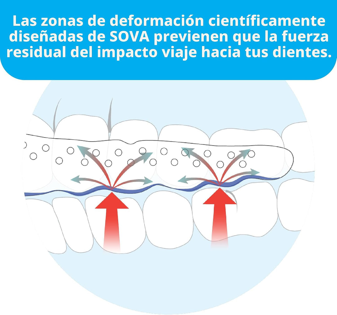 Protector dental de noche Sova con estuche, para bruxismo, TMX, dol...