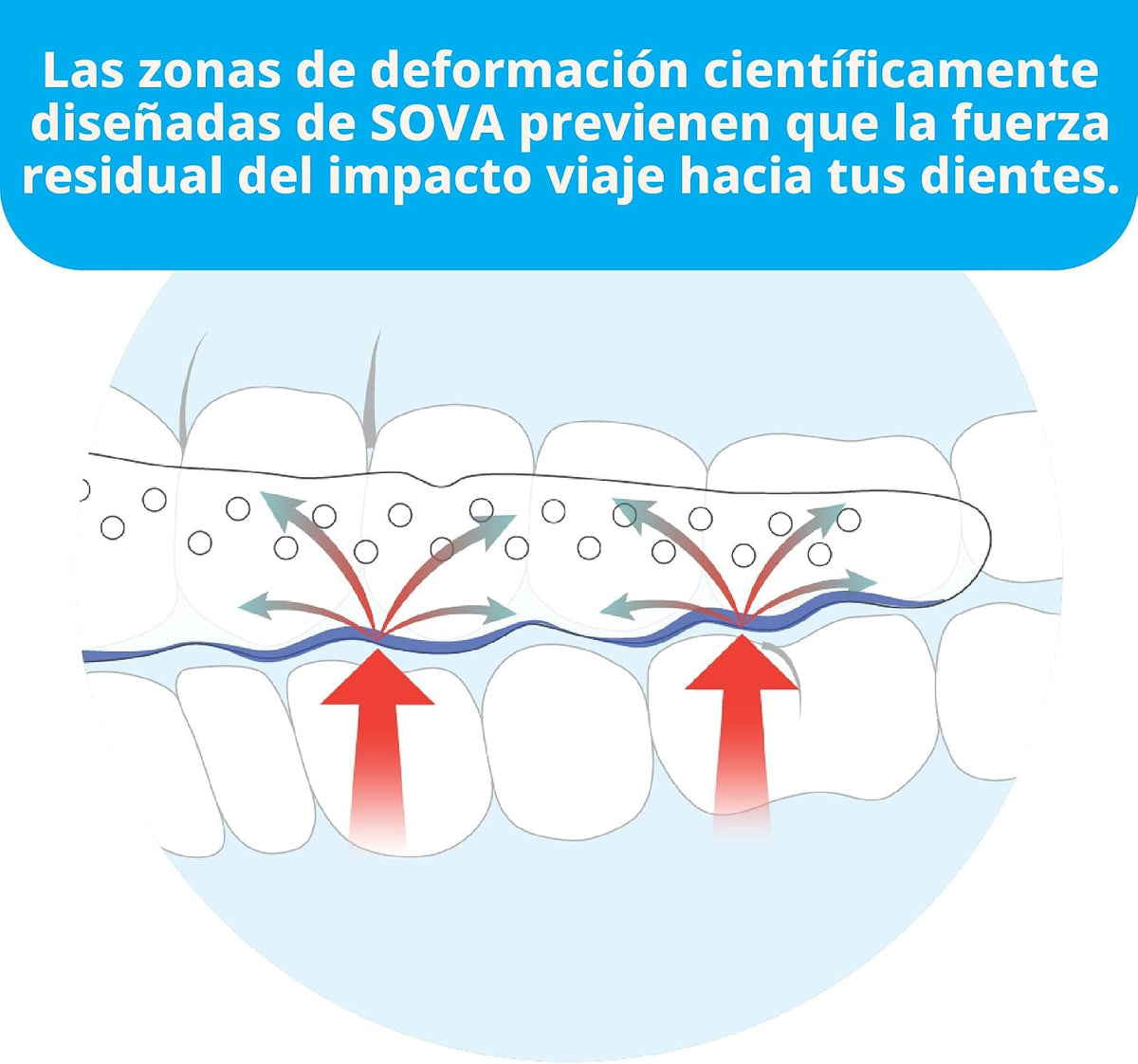 Protector dental de noche Sova con estuche, para bruxismo, TMX, dol...