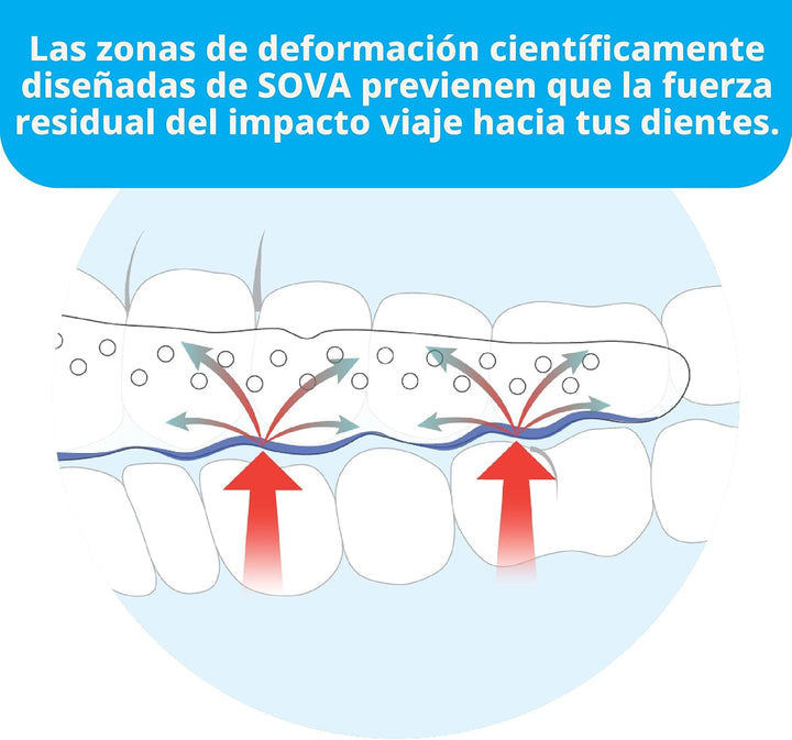 Protector dental de noche Sova con estuche, para bruxismo, TMX, dol...