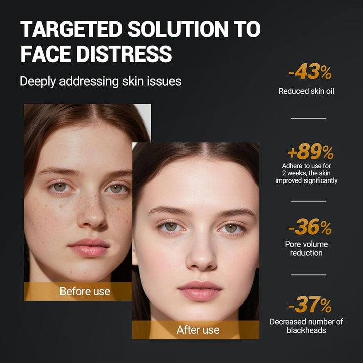 Máscara de arcilla y máscara facial de barro \u2013 Mascarilla puri...