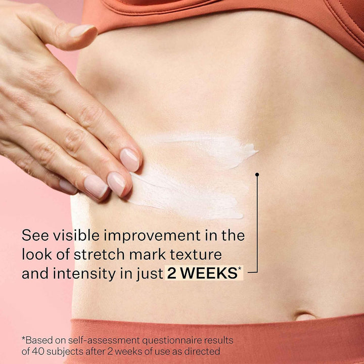 StriVectin SD Advanced Plus Hidratante Intensivo para Arrugas y Est...