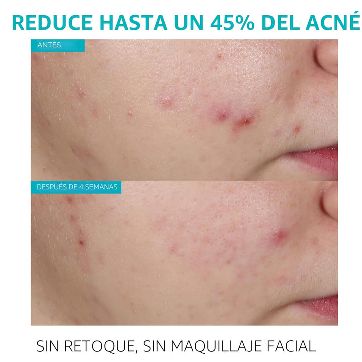 La Roche-Posay Effaclar - Suero de ácido salicílico al 1,5%, tratam...