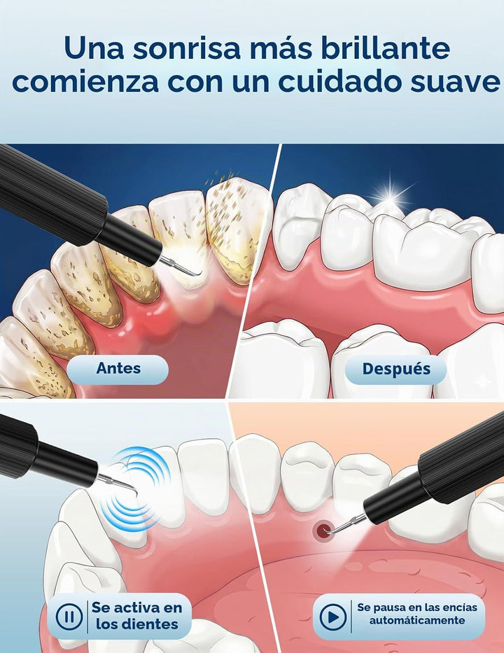 Removedor de placa ultrasónico para dientes, removedor de sarro den...