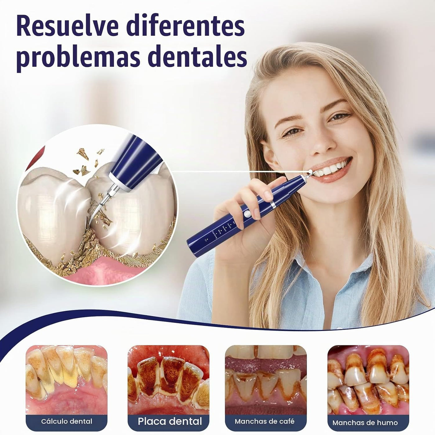 Removedor de placa para dientes, removedor de sarro para dientes, k...