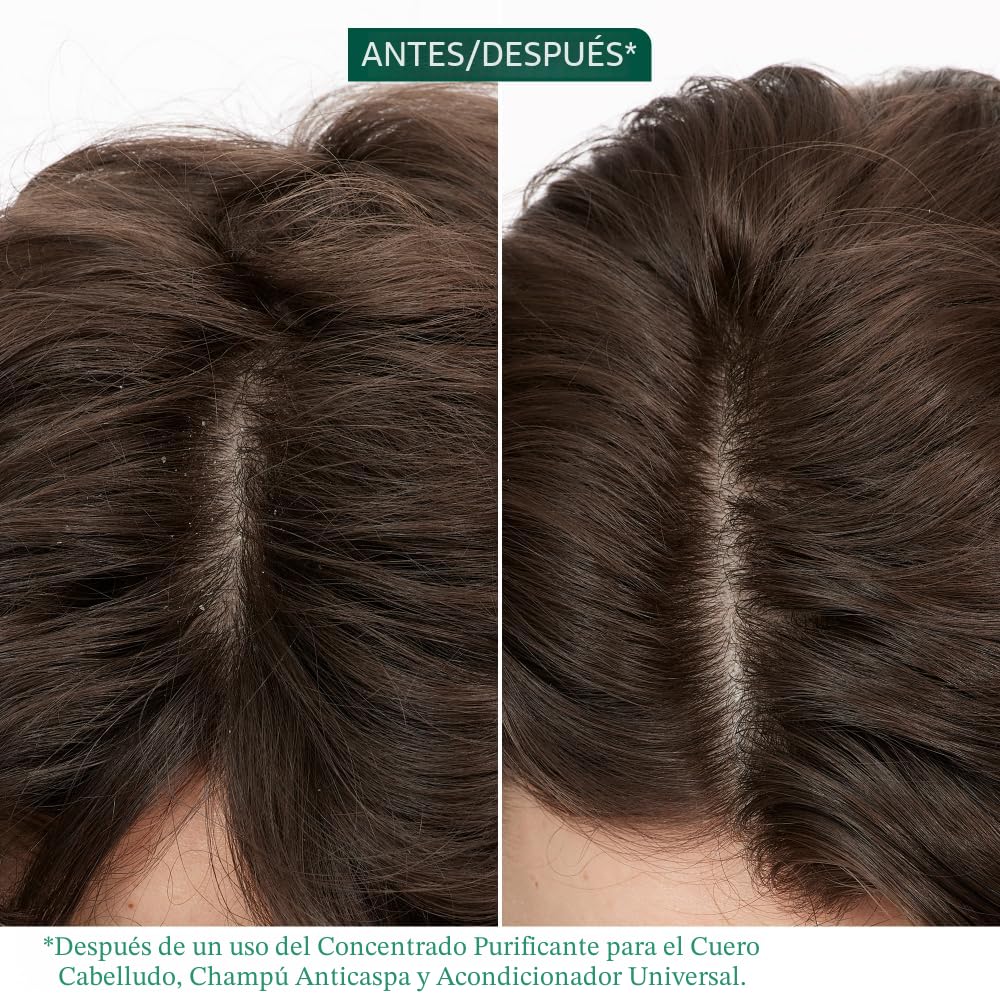 Biolage Scalp Sync - Concentrado purificador - Tratamiento exfolian...