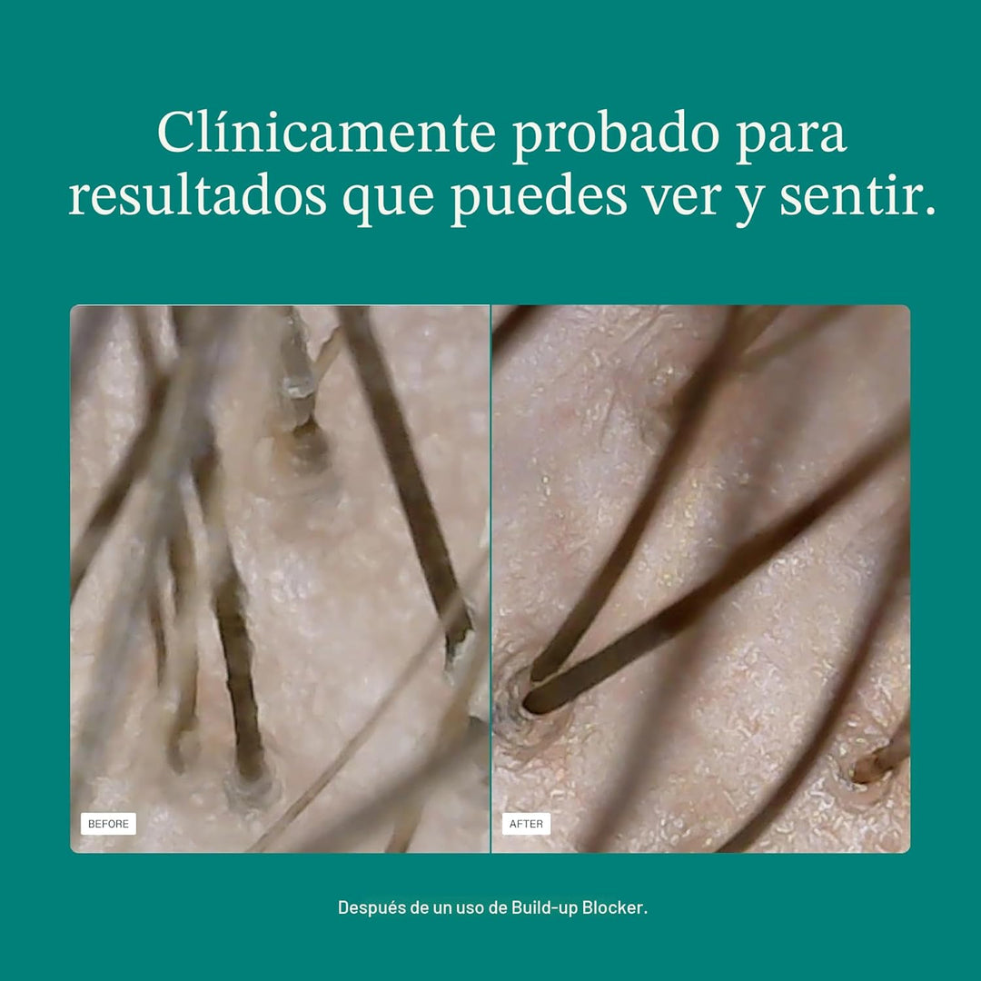 Nutrafol Máscara Exfoliante para el Cuero Cabelludo, Elimina la Acu...