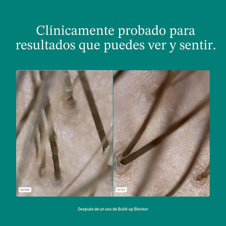 Nutrafol Máscara Exfoliante para el Cuero Cabelludo, Elimina la Acu...