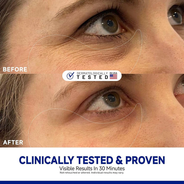 Dr Vincent Peptide Jojoba parches debajo de los ojos, máscara de co...