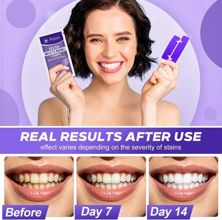 Tiras blanqueadoras de dientes moradas \u2013 20 tiras blanqueadora...