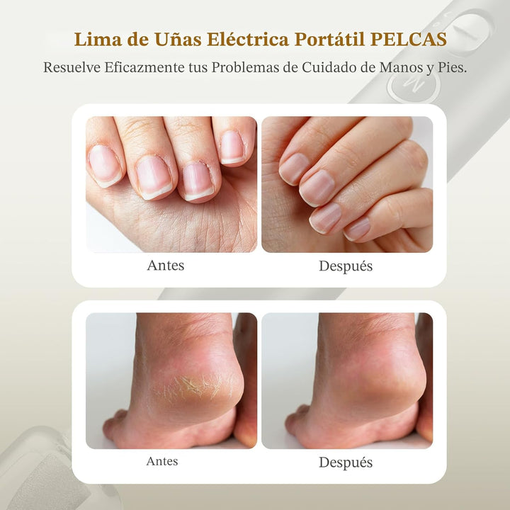 PELCAS Limadora de Uñas Eléctrica, taladro de uñas inalámbrico de 1...