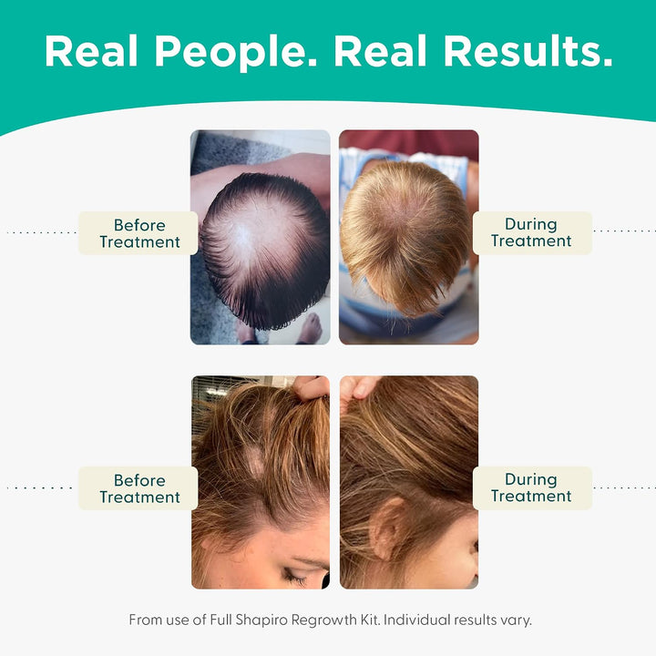 Shapiro MD Hair Growth Experts Champú vegano para adelgazar el cabe...