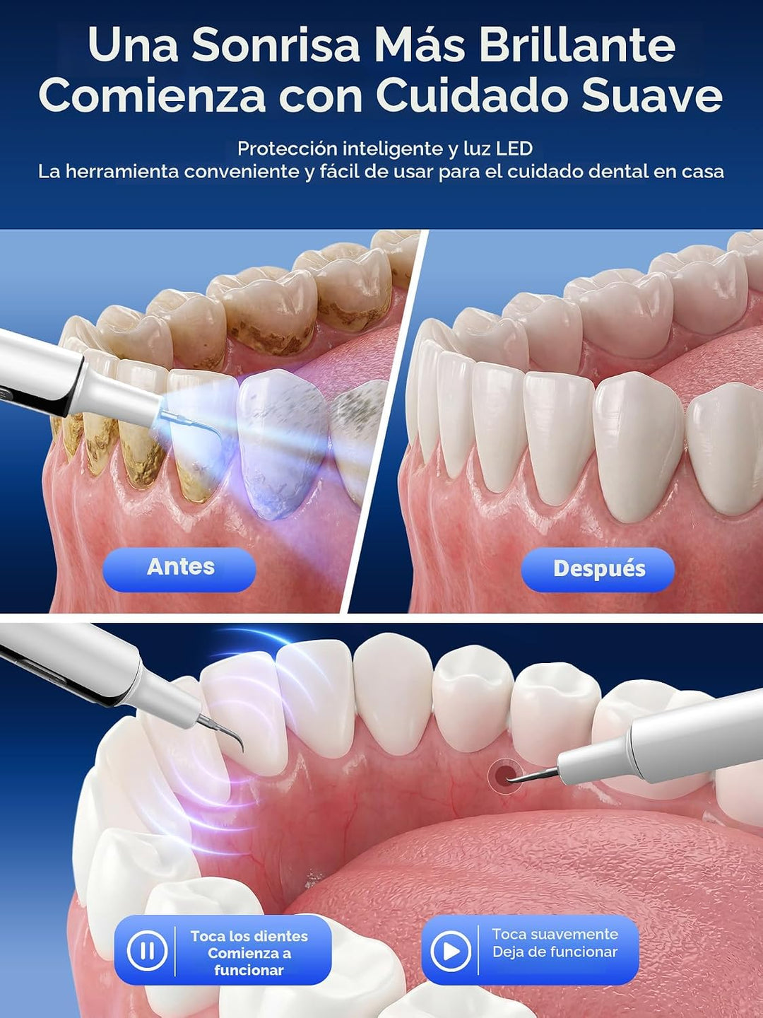 Removedor ultrasónico de placa para dientes, removedor de sarro de...