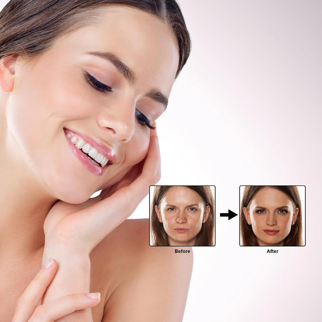 Elitzia Kit facial de CO\u2082 - 6 juegos por caja para máquina fac...