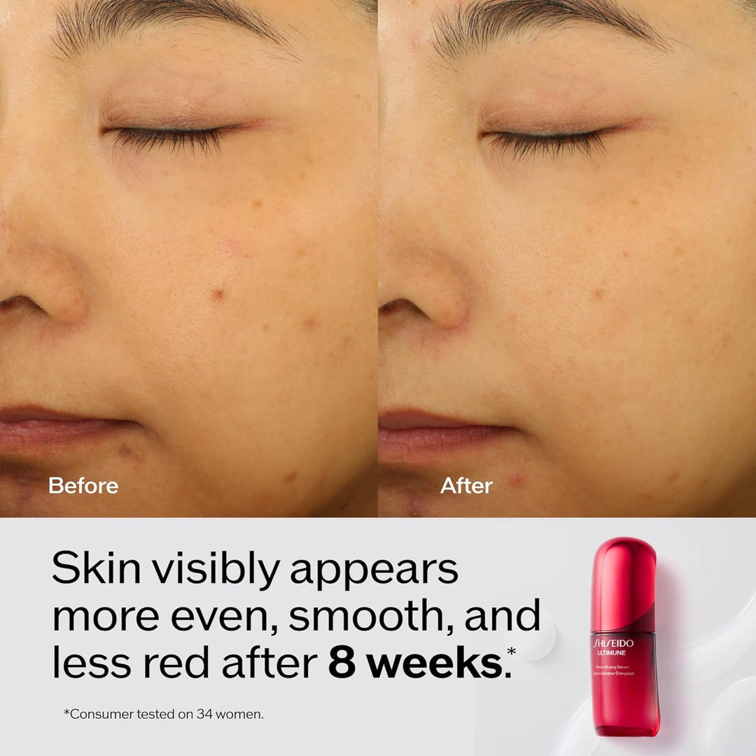 Shiseido Ultimune Power Infusion Serum - Suero facial ligero innova...