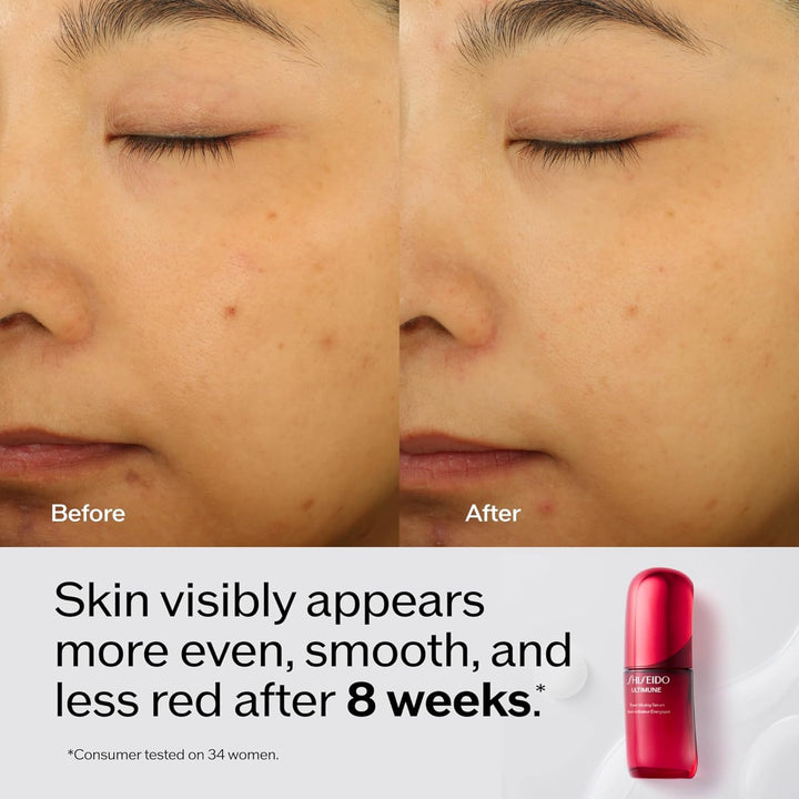 Shiseido Ultimune Power Infusion Serum - Suero facial ligero innova...
