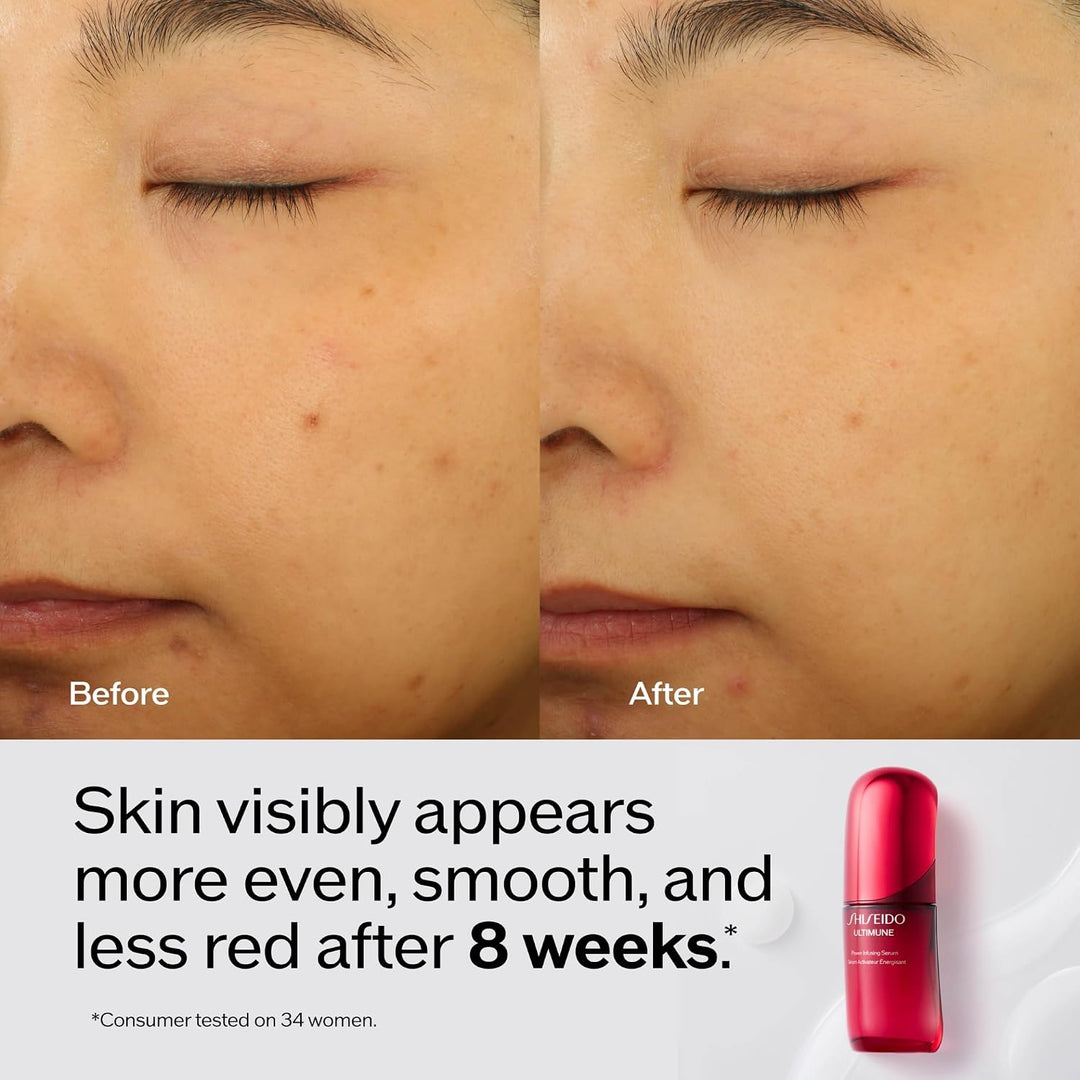 Shiseido Ultimune Power Infusion Serum - Suero facial ligero innova...