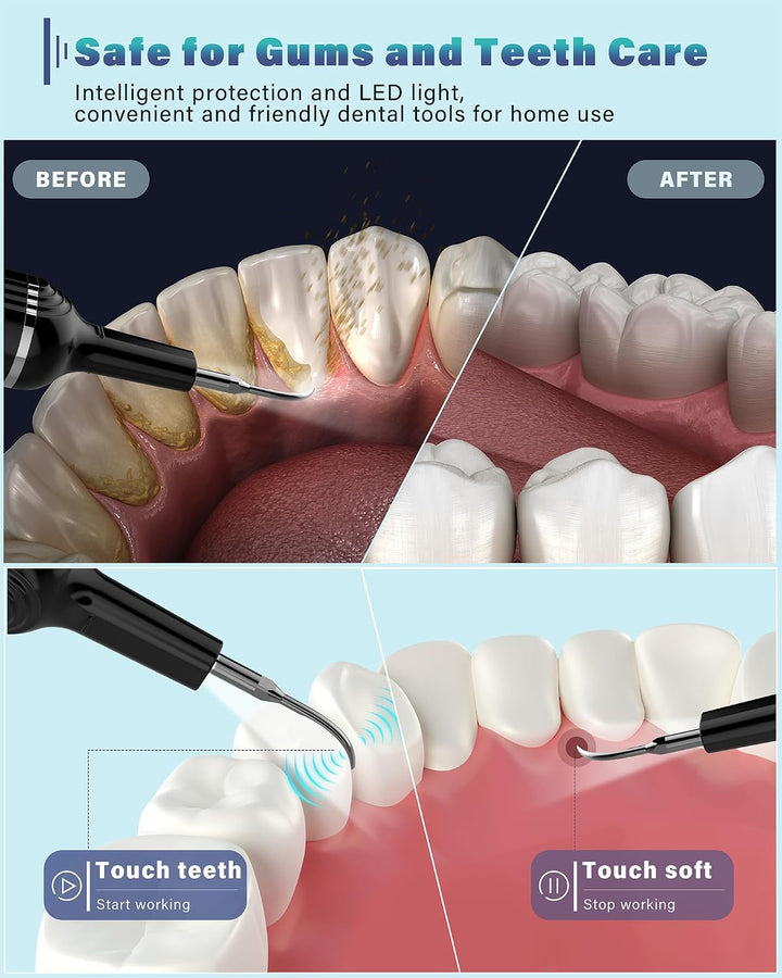 Removedor de placa para dientes, kit de limpieza dental removedor d...