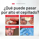 Hismile iD - Enjuague bucal blanqueador de manchas, enjuague bucal...