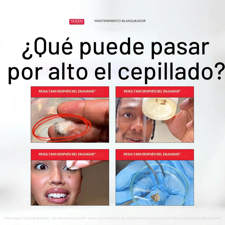 Hismile iD - Enjuague bucal blanqueador de manchas, enjuague bucal...