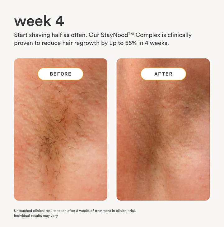 Nood™ Serum | Después del afeitado para evitar el vello encarnado y...