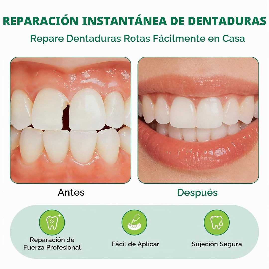 Adhesivo instantáneo de laboratorio dental, kit adhesivo profesiona...