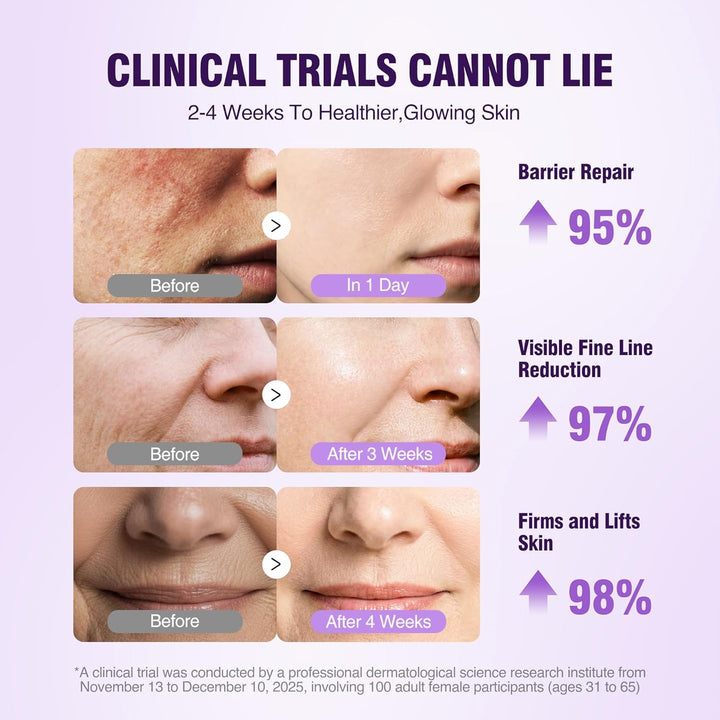 Suero de péptidos de retinol para la cara: suero de colágeno reafir...