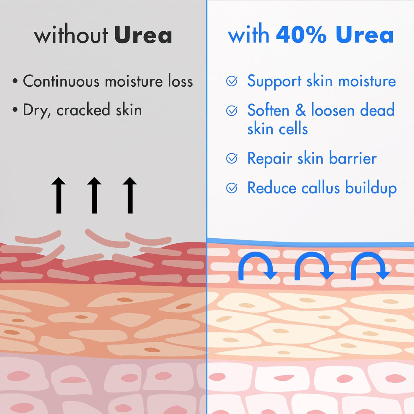 Ebanel Crema de urea 40% más ácido salicílico, paquete de 3 unidade...
