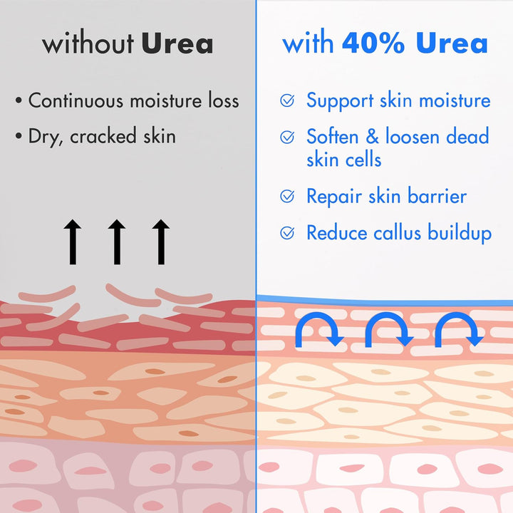 Ebanel Crema de urea 40% más ácido salicílico, paquete de 3 unidade...