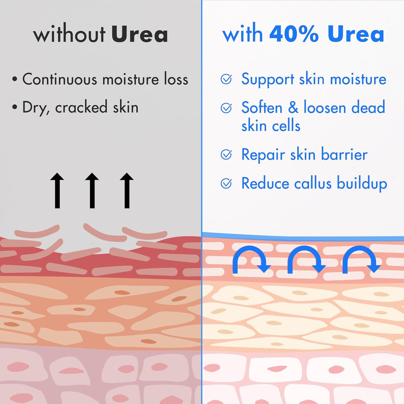 Ebanel Crema de urea 40% más ácido salicílico 2%, crema de pies par...