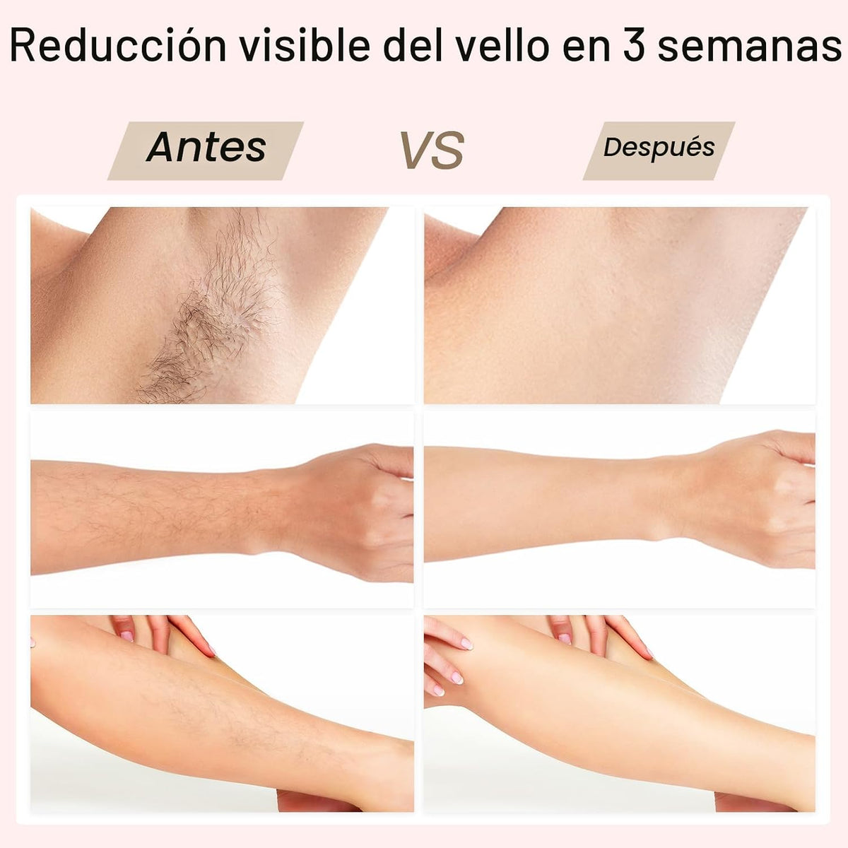 Depilación Láser, BoSidin Depilación IPL con Enfriamiento de Hielo...
