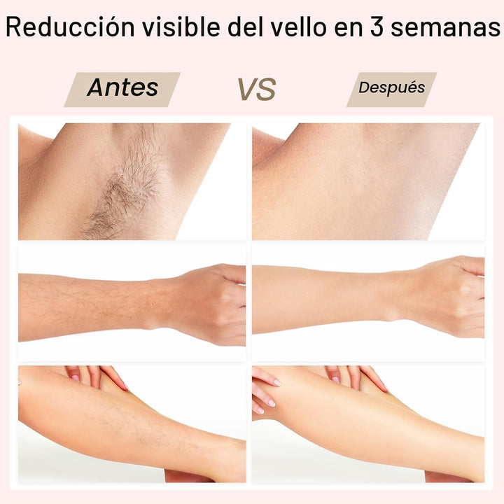 Depilación Láser, BoSidin Depilación IPL con Enfriamiento de Hielo...