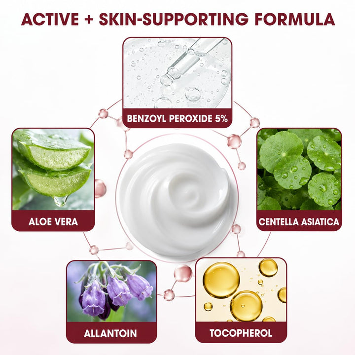 Crema de tratamiento de foliculitis con 5% de peróxido de benzoilo...