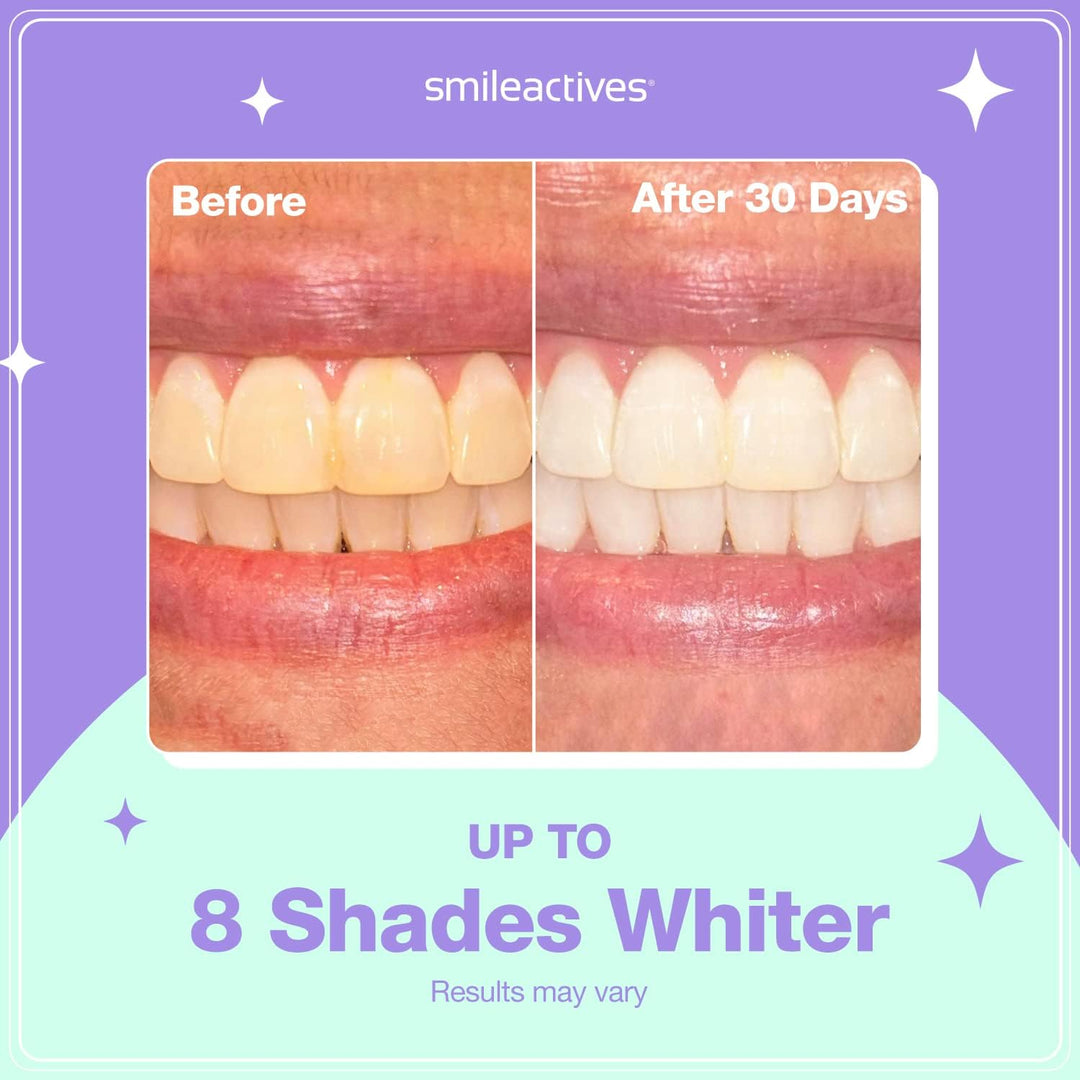 Smileactives Kit de blanqueamiento dental, tratamiento completo de...