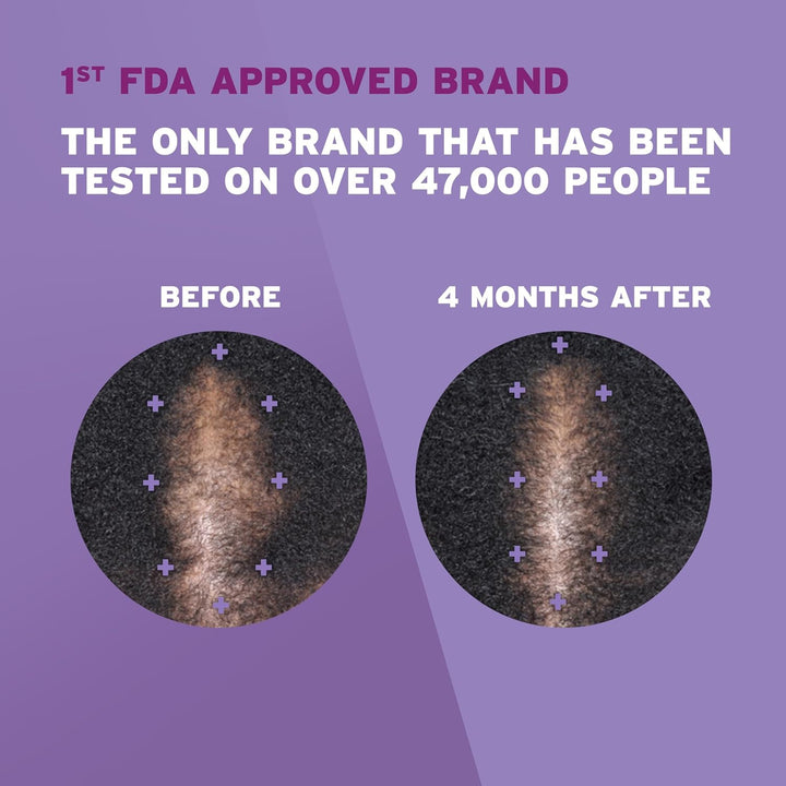 Rogaine - Espuma de minoxidil tópica al 5%, tratamiento contra la c...