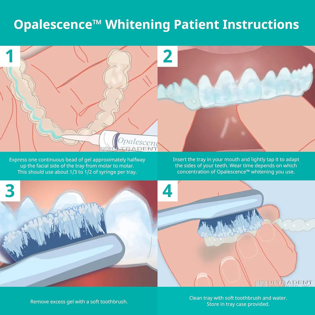 Opalescence 35% CP Mint - Jeringas de gel para blanquear los diente...