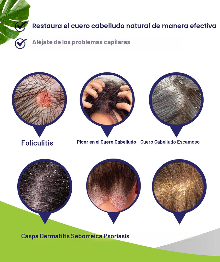 PHARMBANNER Champú antifúngico para foliculitis, dermatitis seborre...