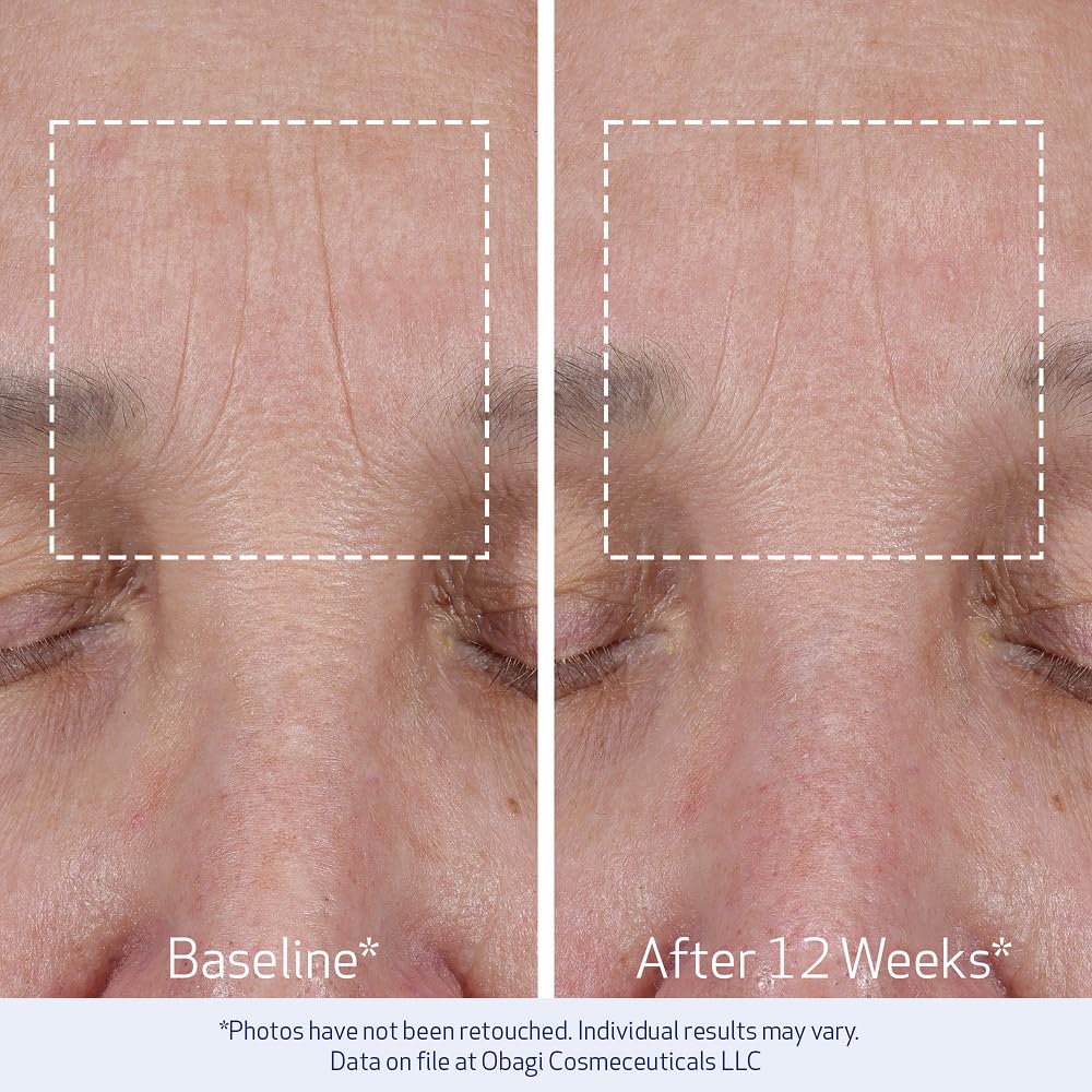 Obagi ELASTIderm Lift Up & Sculpt - Crema facial