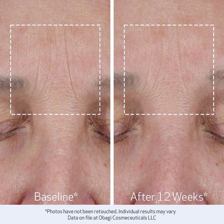 Obagi ELASTIderm Lift Up &amp; Sculpt - Crema facial antienvejecimi...