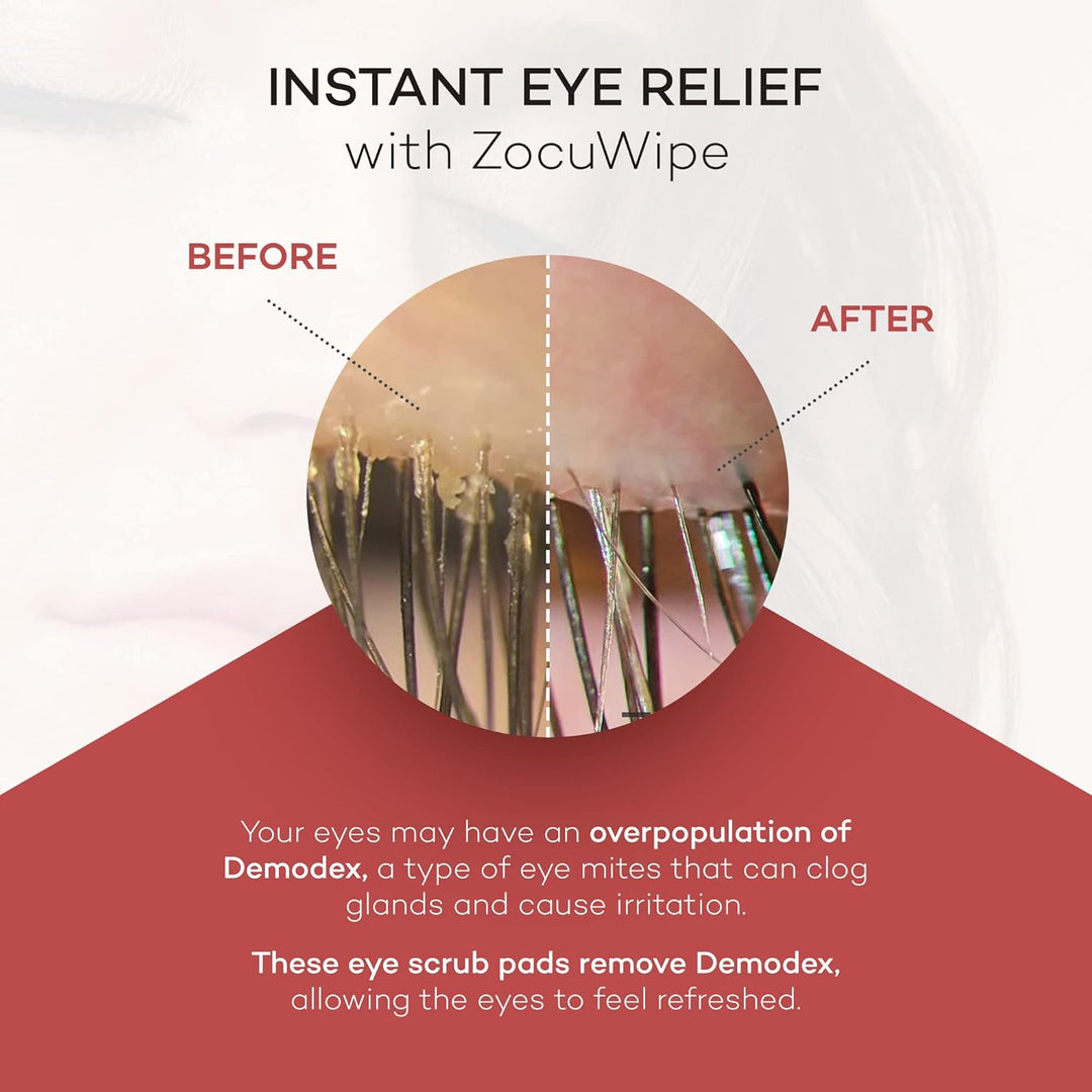 Zocular ZocuWipe Toallitas limpiadoras de párpados con complejo nat...