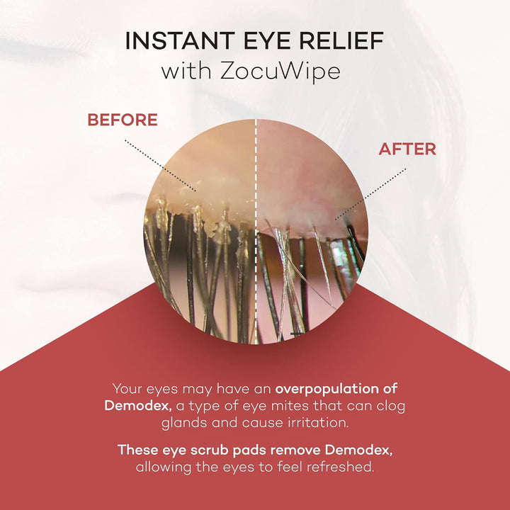 Zocular ZocuWipe Toallitas limpiadoras de párpados con complejo nat...