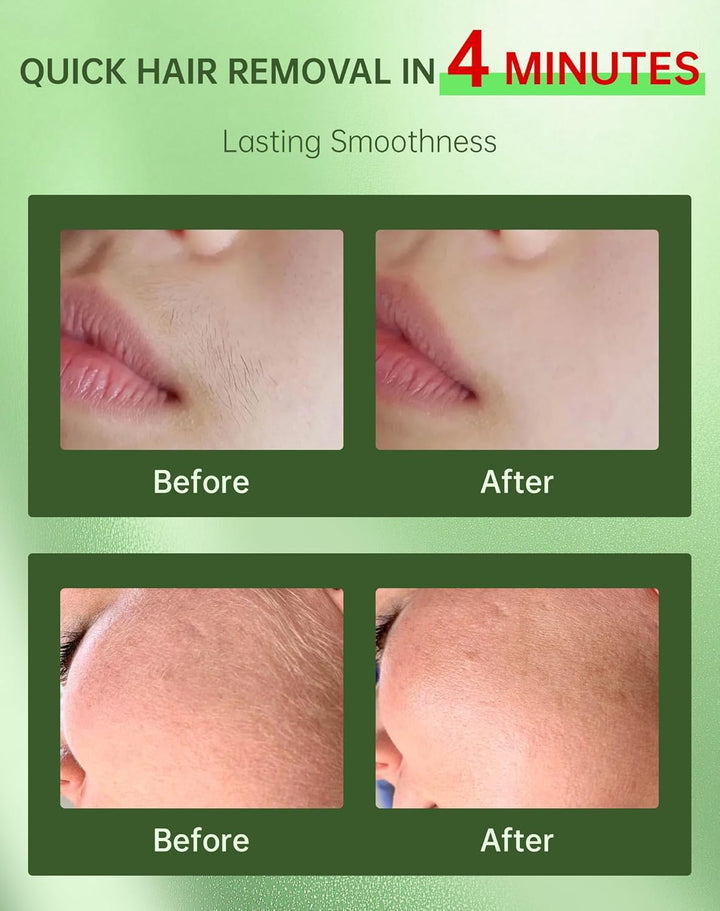 Depilación facial para mujeres + crema calmante, removedor de vello...