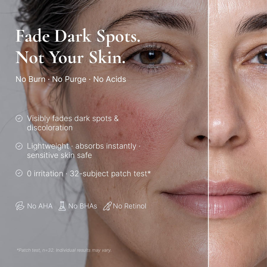 EnaSkin Corrector de manchas oscuras para rostro y cuerpo - 5% ácid...