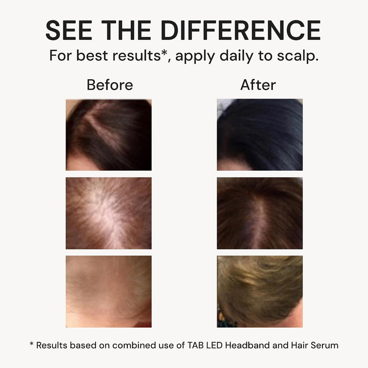 TAB Tech - Suero activado para el cabello y el cuero cabelludo, fór...