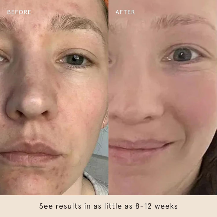 Barefaced Almohadillas Glow Peel (60 unidades) \u2013 Almohadillas...