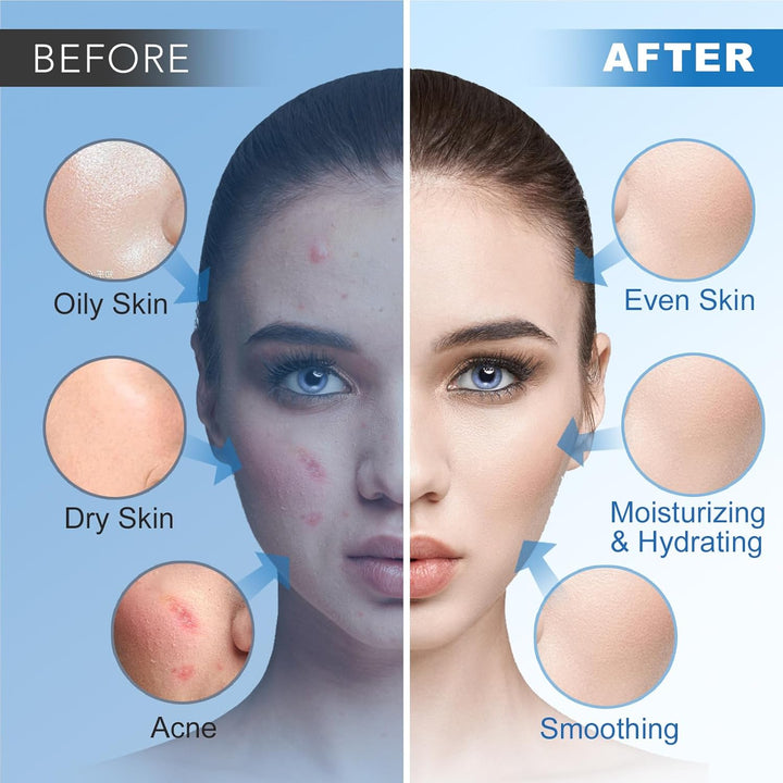 Angeland Mascarilla de gelatina para tratamientos faciales profesio...