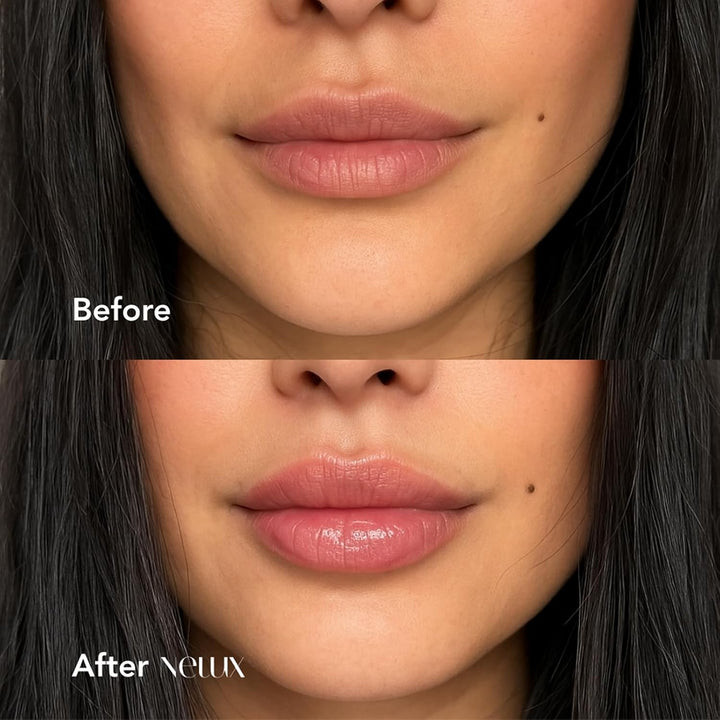 Nelux Lápiz labial Nelux con ácido hialurónico, hidratación instant...