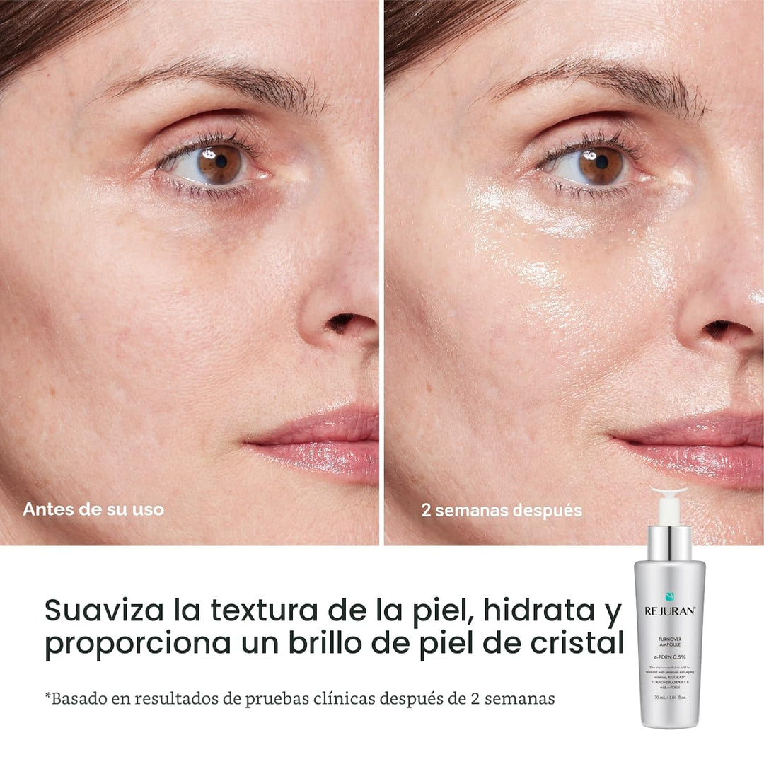 REJURAN® Ampolla Turnover, c-PDRN® \u2013 Suero facial original de...