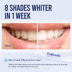 VieBeauti Kit de blanqueamiento dental con luz LED para dientes